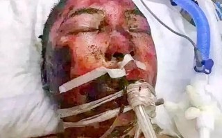 王者荣耀重伤刀的战术策略与技巧